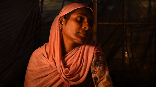 Almas Khatun from Tula Toli village in Myanmar reveals the scars from where her throat and face were cut by the Myanmar military and monks.