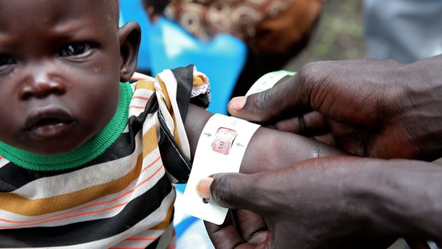 Nyatut was identified as being severely malnourished at The Save the Children feeding centre in Denjuok, South Sudan, last year. Reducing poverty and hunger was a major aim of the Millennium Development Goals.
