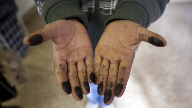 An asylum seeker shows his inked fingers at the central receiving facility for refugees in Berlin.