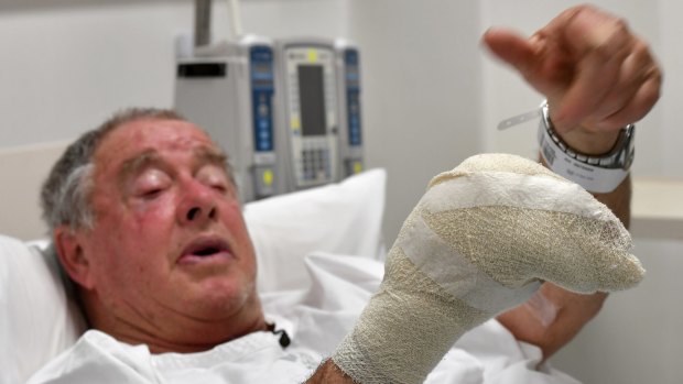 Rod McFarlane recovers from his injuries in The Alfred hospital.