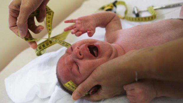 A doctor in Brazil measures the head of a two-month-old baby with microcephaly.