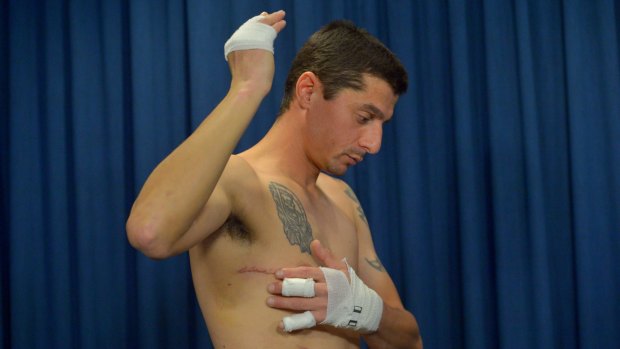 Good Samaritan Bernard Oxenham shows wounds after being stabbed. 