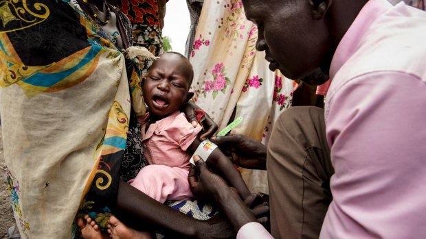 Undernourished: A starving one-year-old boy is registered for a feeding program in South Sudan.