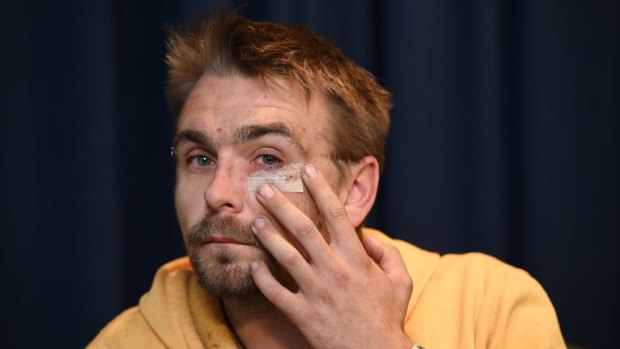 Victim of road rage incident touches his face where he was assaulted with a gun.