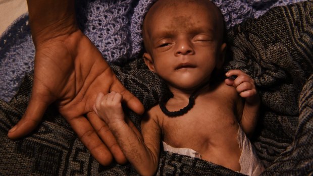 Laila Begum holds her son Mohammed Ifran's hand as he receives treatment at a Red Cross field hospital in a refugee camp. Mohammed, 40 days old, is malnourished and weighs 1.8 kilograms.