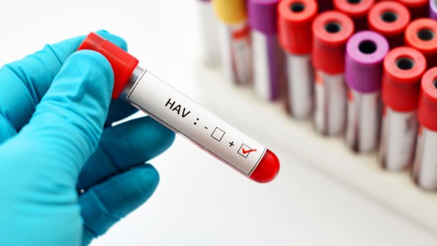 Hepatitis A virus (HAV) positive.