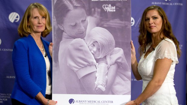 Susan Berger, left, and Amanda Scarpinati with a copy of the 1977 photo when they met at Albany Medical Centre on Tuesday.