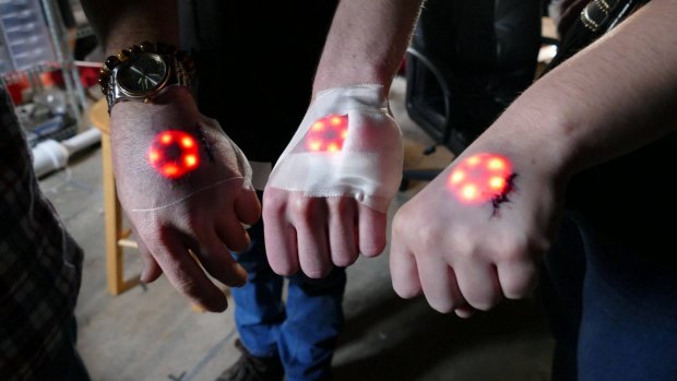 Biohackers with Northstar devices freshly installed in their hands. 