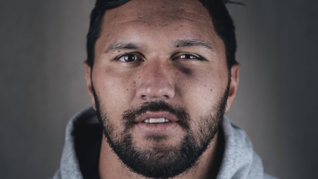 Canberra Raiders winger Jordan Rapana shows off a swollen face.