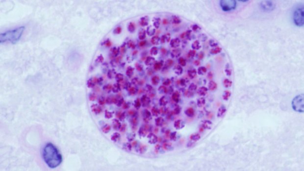 A toxoplasma gondii cyst, shown here in a mouse brain.