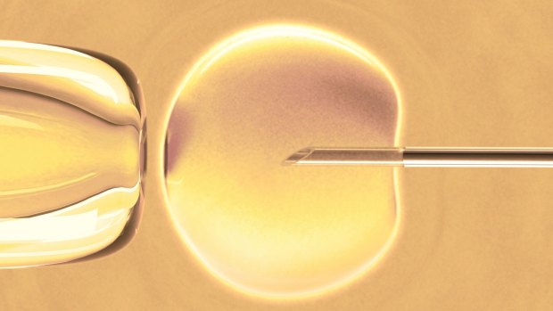 IVF cycles in Australia dipped in 2017 but a bigger concern for big ASX companies specialising in the area is competition from low-cost providers. 