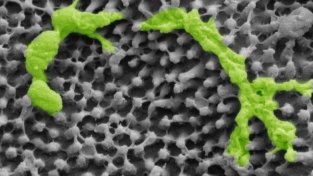 Bacteria (Streptococcus mutans) highlighted in green resting on a cicada wing's microscopic structures.  