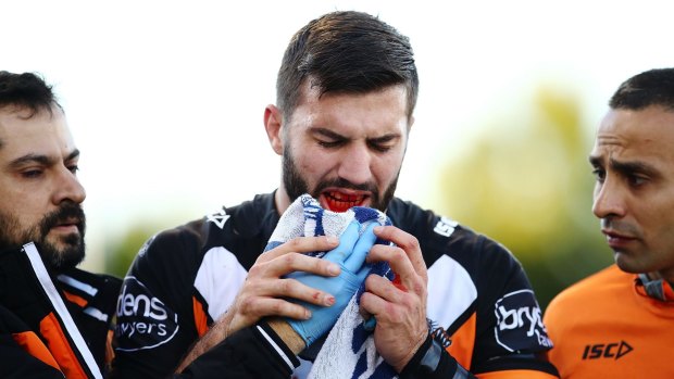 Major blow: James Tedesco leaves the field with a broken jaw.