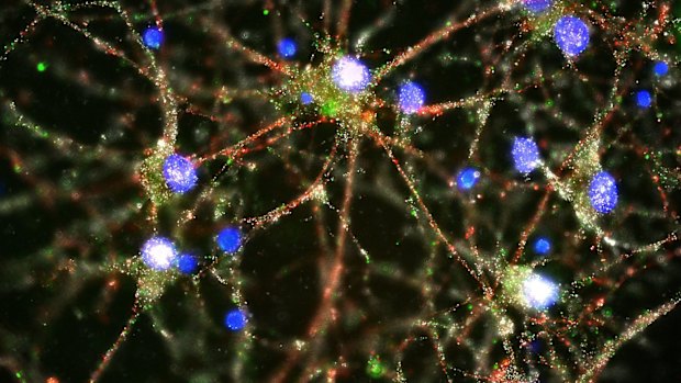 Scientists pursuing the biological roots of schizophrenia have zeroed in on a potential factor, a normal brain process that gets kicked into overdrive. 