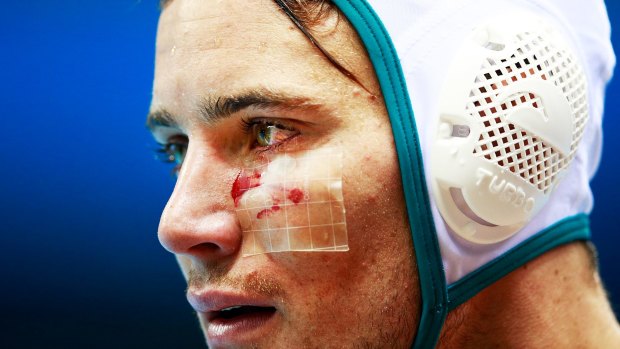 Aidan Roach of Australia is cut on the face during the Australia vs Greece match.