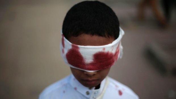 A boy with fake blood on his face and clothes to represent a victim participates in a protest against Saudi-led airstrikes in Sanaa, Yemen, in November 2016.