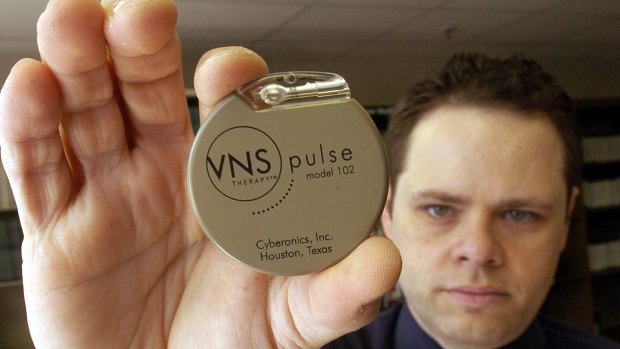 The Vagus Nerve Stimulation device is implanted in the chest like a pacemaker.