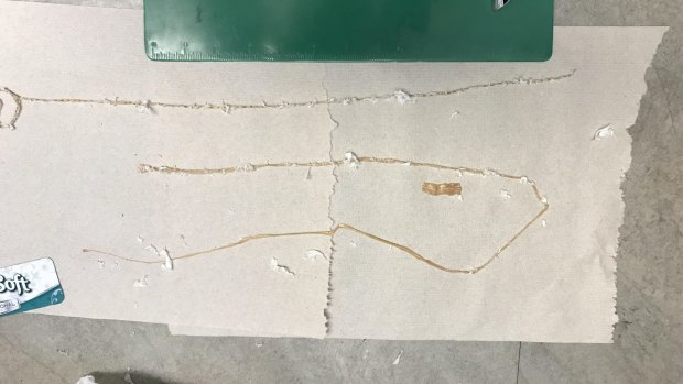 Dr Kenny Banh, the emergency physician at the University of California at San Francisco, in Fresno, stretched out the tapeworm on the ER floor and measured it - all 1.5 metres of it.