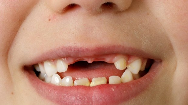 The scheme offering free dental care to children from middle to low income families is under threat. 