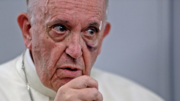 Pope Francis warns of the perils of climate change to humanity. 