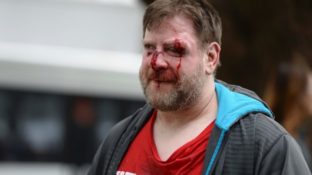 A Trump supporter is injured after sides clash at a rally for President Donald Trump at Martin Luther King Jr. Civic Center Park in Berkeley, California on March 4.