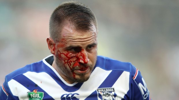 Bruised and beaten: Josh Reynolds sports a bloodied face after making a tackle on James Tedesco.