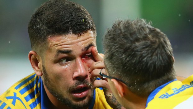 Nathan Peats, one of the Eels' casualties on Monday night, has his eye checked by medical staff.