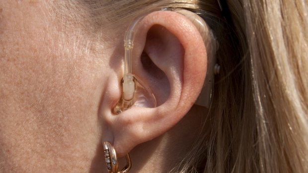 Hearing aids range in price from around $1500 to $15,000 a pair, the ACCC says.