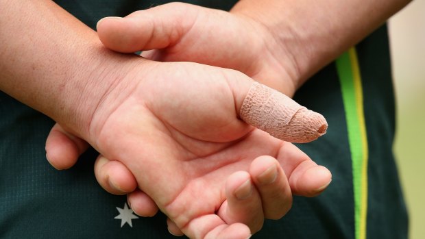 A close-up view of David Warner's thumb at the MCG on Tuesday.