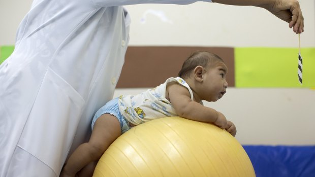 Beijamin Santos, who was born with microcephaly, undergoes physical therapy at a centre in Joao Pessoa, Brazil.  