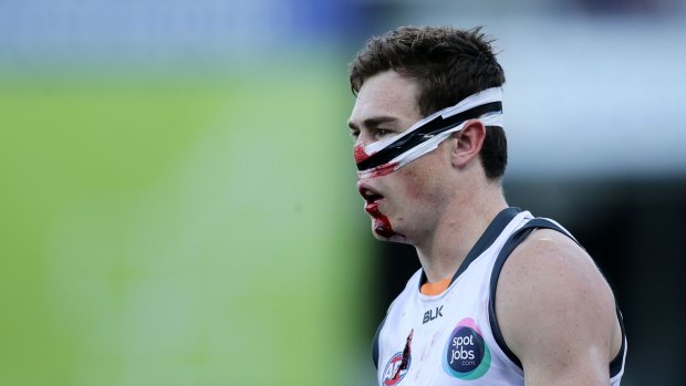 Jeremy Cameron looked a mess after Zac Dawson struck him on Sunday.