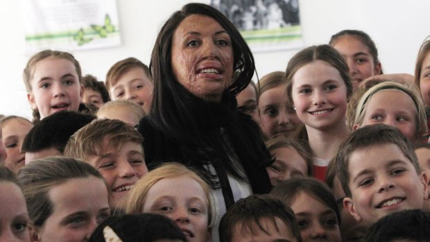 Turia Pitt as an inspiration speaker with students at Gwynneville.