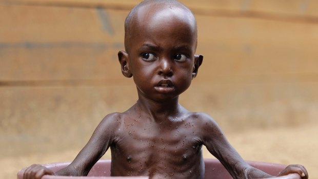 Two-year-old Aden Salaad, in 2011, a refugee in Dadaab, Kenya. Africa has a keen interest in reducing global warming risks given its exposure to extreme weather and widespread poverty.