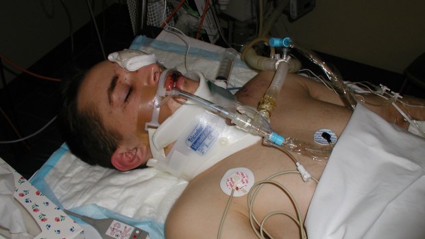 James Thompson in hospital following his motorcycle crash in 2002.