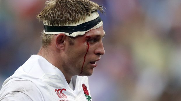 Bloody: England's Tom Youngs.