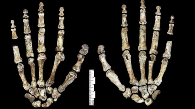 The features of <i>Homo naledi</i> are similar to other early hominids, with human-like face, feet and hands.