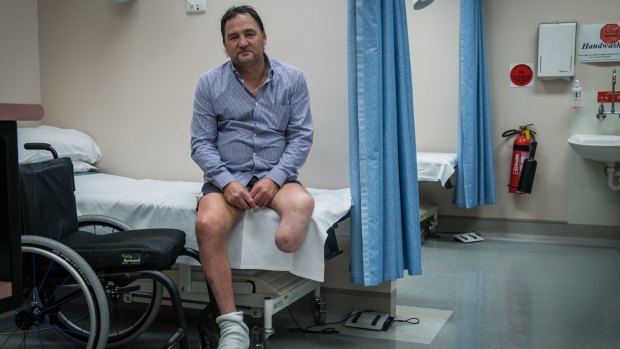 Diabetes sufferer Julian Robinson has lost one leg to the disease and is battling to save his other.  