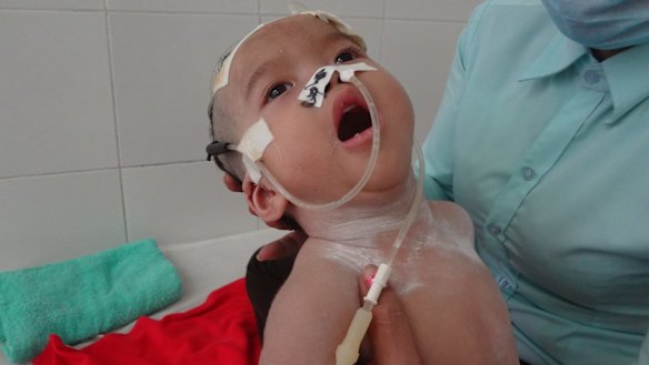 Sok Ravuth was abandoned on a Cambodian rubbish dump in 2014 when he was 18 months old. Now severely disabled and needing around-the-clock care, Sok Ravuth is cared for in a centre run by Scott Neeson's Cambodian Children's Fund. 