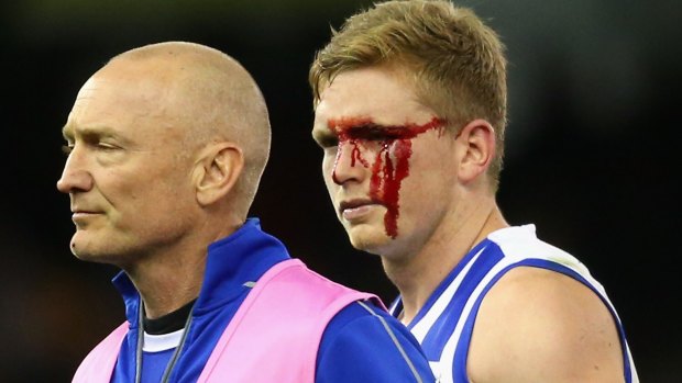 Jack Ziebell of the Kangaroos comes off the ground with a cut eye.