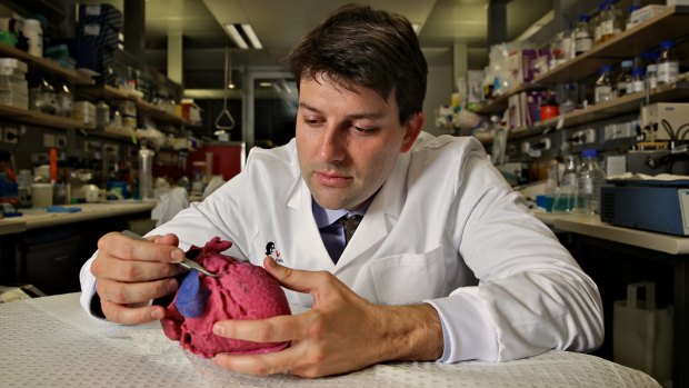 Dr James Otton with a replica of a heart built with a 3D printer. 