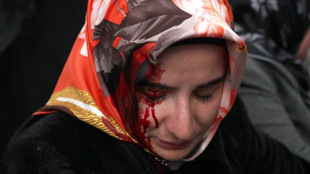 A woman bleeds from an injury after riot police disperse supporters of the Zaman newspaper.