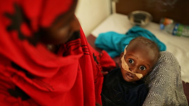 Halima Osman with her child, Mustafa, 14 months. Mustafa is treated for severe malnutrition at Hargeisa Group Hospital.