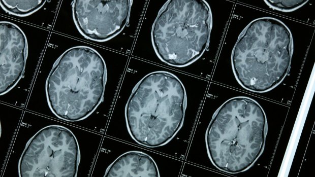 Stroke victims are likely to have further strokes in the next few years.