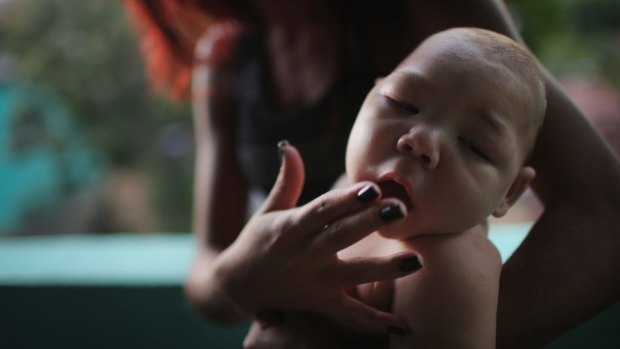 Estafany Perreira holds her five-month-old nephew David, who has microcephaly, in Recife, Brazil.