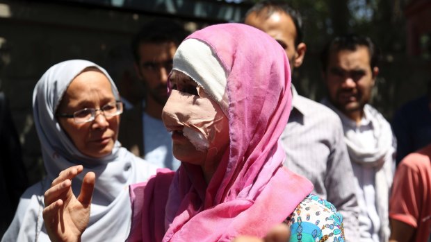 An injured woman is seen after the suicide attack in Kabul, Afghanistan.