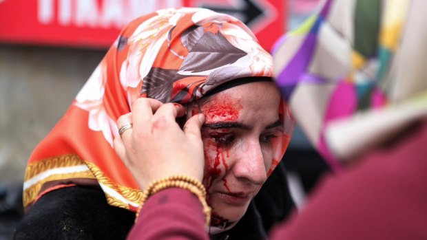 An injured woman is attended to as riot police use water cannons on supporters of the Zaman newspaper in Istanbul.