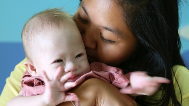 Pattharamon Janbua, right, kisses her baby boy Gammy at a hospital in Chonburi province, Thailand.