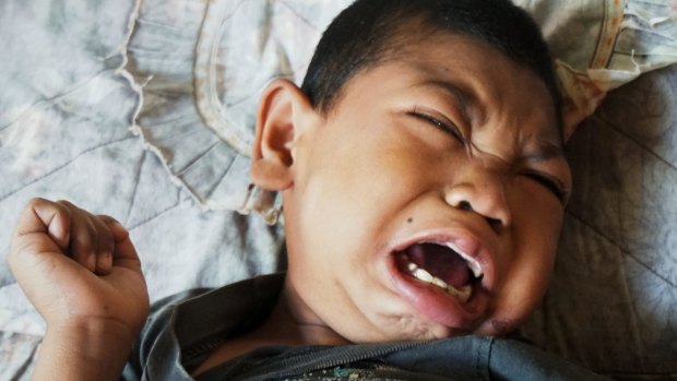 Muhammad Fikri, aged eight, suffers from severe mental and physical disabilities. 