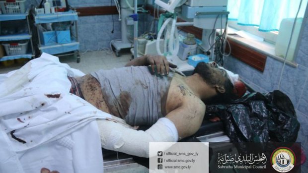 A wounded man lies in a hospital after US warplanes struck an Islamic State training camp in Sabratha.