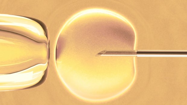 IVF cycles in Australia dipped in 2017 but a bigger concern for big ASX companies specialising in the area is competition from low-cost providers. 